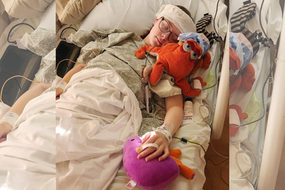A Year After A Renal Autotransplant